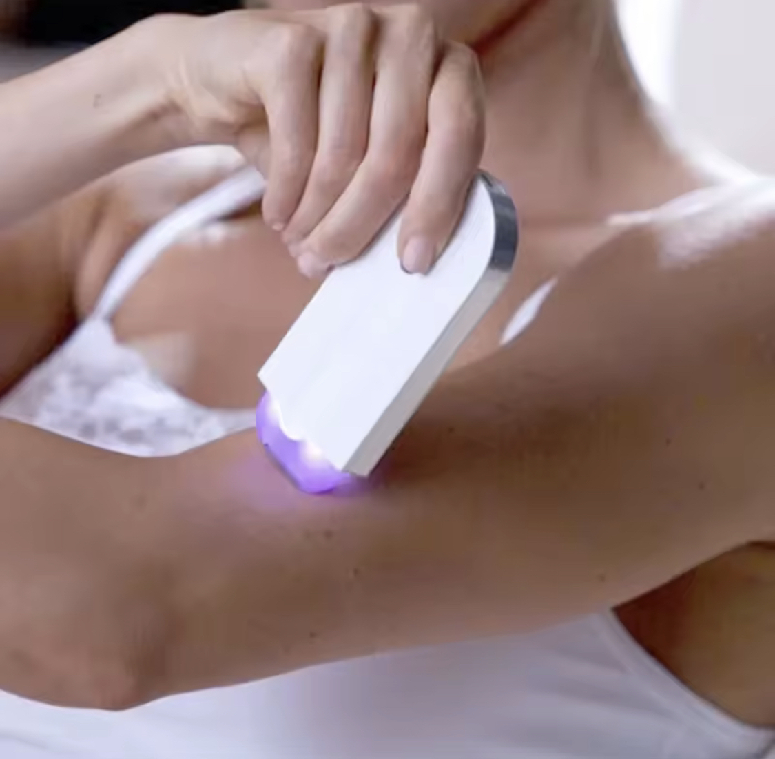 REMOVEDOR DE VELLO DEPILADORA YESS